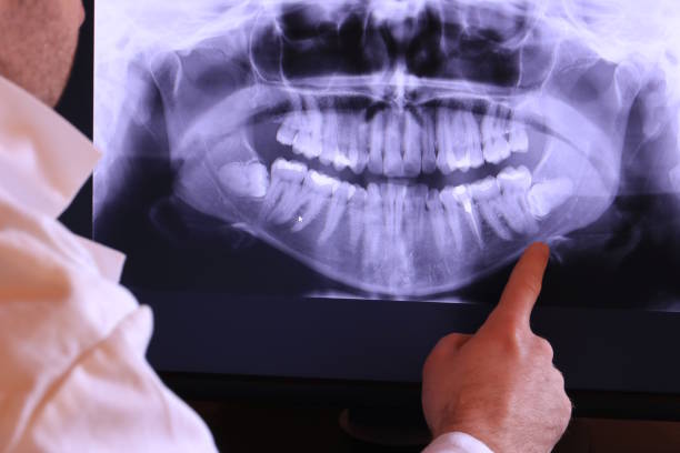 Best Mobile Emergency Dentist in Fort Washington, PA