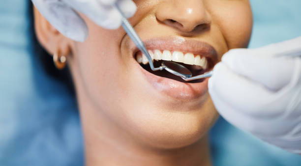 Best Emergency Dentist for Knocked-Out Tooth in Fort Washington, PA